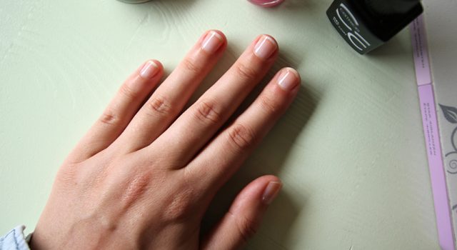 stoppen met nagelbijten